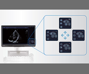 Aplio-i-ergo-11.jpg