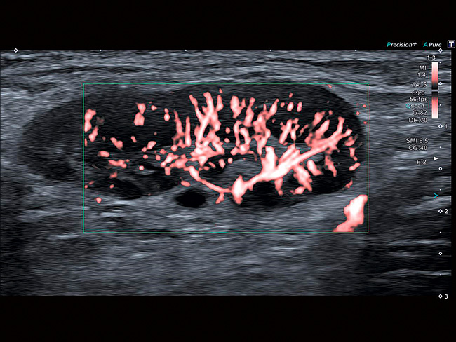 Кольоровий SMI Aplio a550