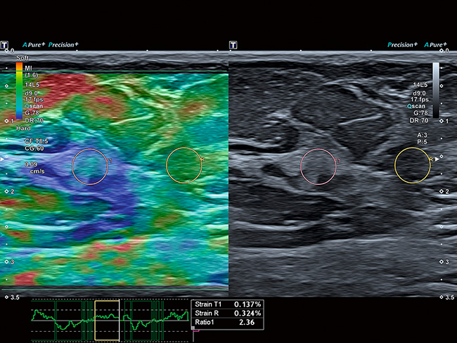 Компресійна еластографія Aplio a550